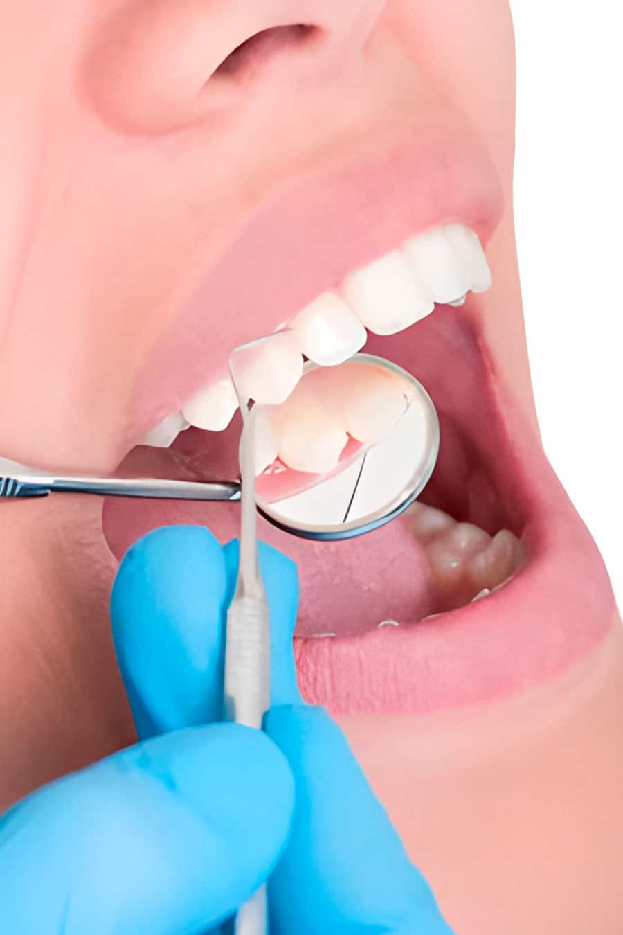 clinica dental bruxismo en donostia clinica dental bruxismo en donostia