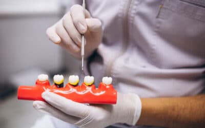 Prevención de la periodontitis: Cuidados y hábitos bucales