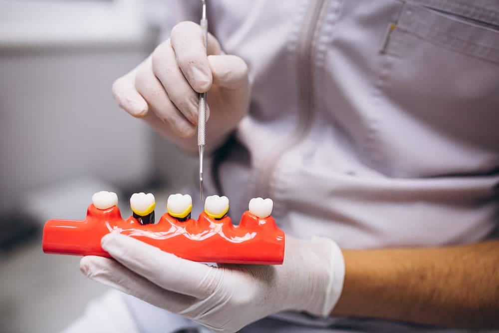 Prevención de la periodontitis: Cuidados y hábitos bucales
