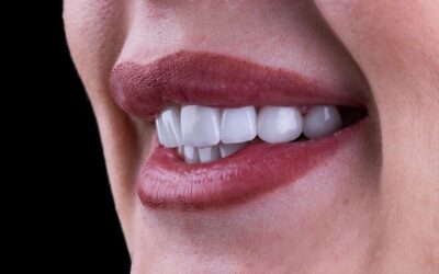 Cómo prevenir y corregir la maloclusión en adultos