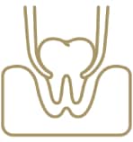 extracción dental