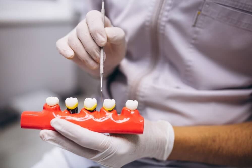 dentista mostrando efectos de la periodoncia en modelo dental