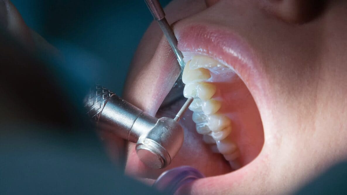 dentista practicando endodoncia paciente dentista practicando endodoncia paciente
