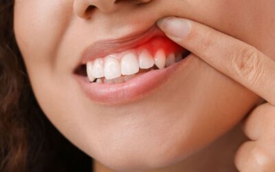Patologías gingivales resectivas y regenerativas