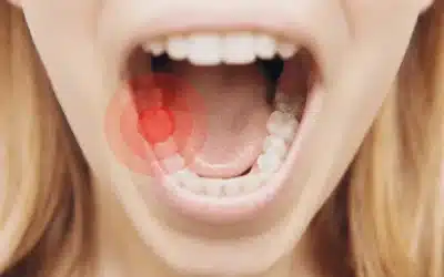 Dolor de muelas: Todo lo que necesitas saber