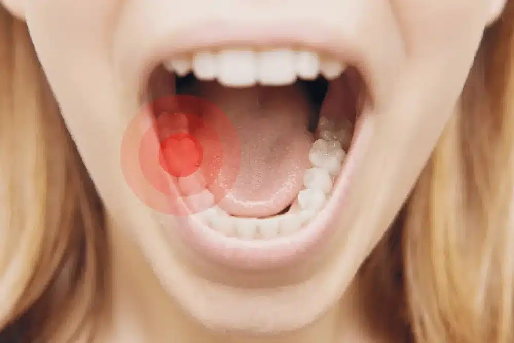 mujer con la boca abierta ensenando todos los dientes