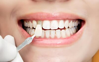 Carilla articular: Características, beneficios y más