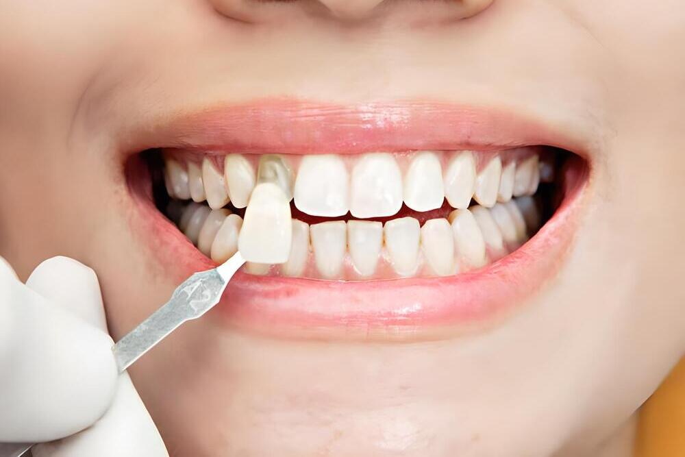 Carilla articular: Características, beneficios y más