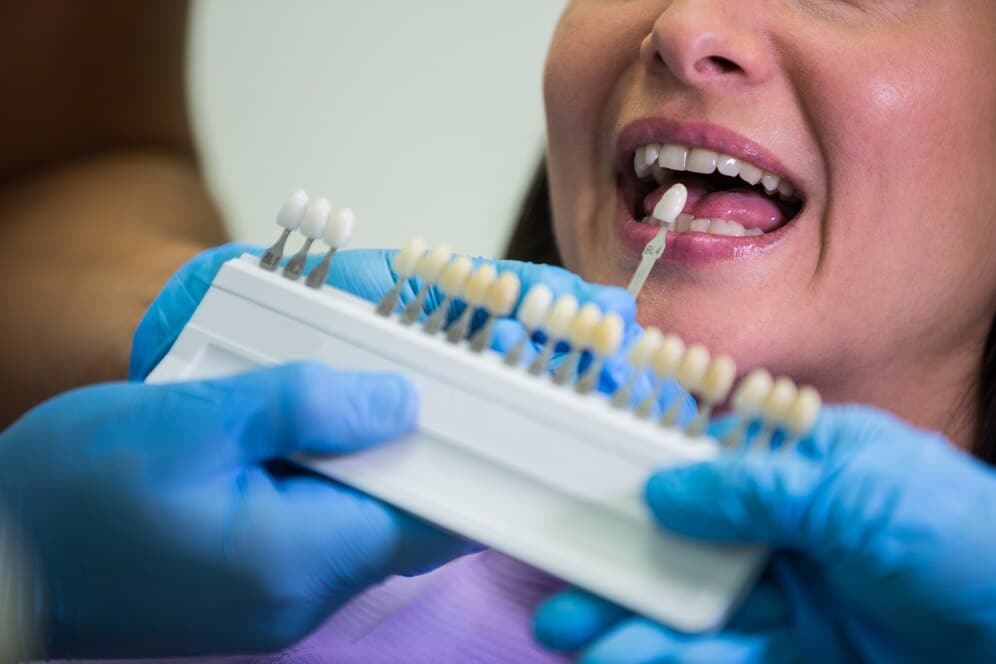 dentista examinando tono dientes paciente mujer
